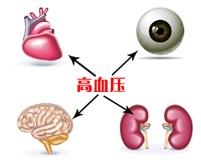 原發(fā)性高血壓的癥狀