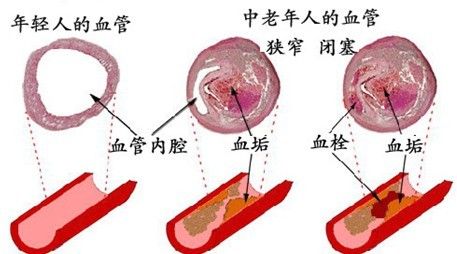 是什么原因?qū)е卵軌勖鼫p少-陜西千秋玄鹿治療儀