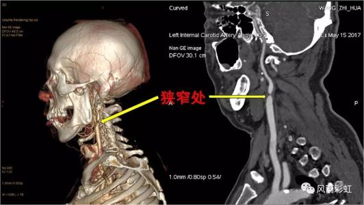 頸椎病都是“積”出來的，4個傷頸的行為，別總是做